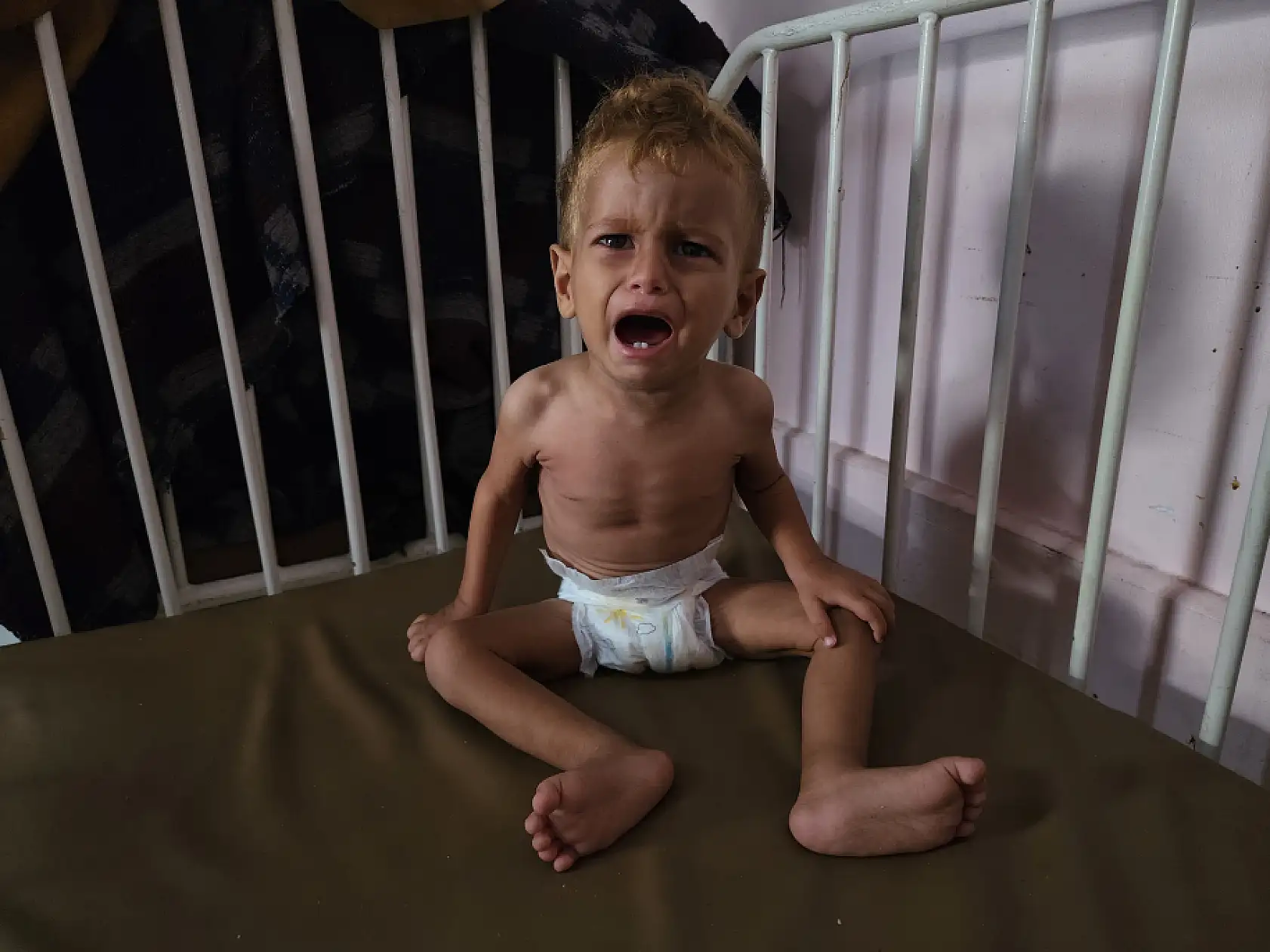 Yetersiz beslenme nedeniyle çocuk ölümleri artıyor!