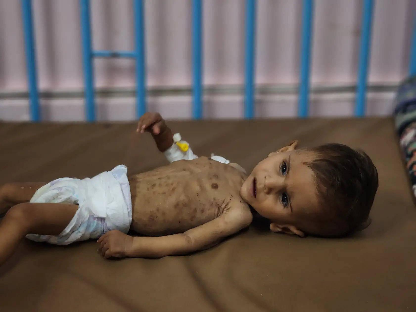 Yetersiz beslenme nedeniyle çocuk ölümleri artıyor!