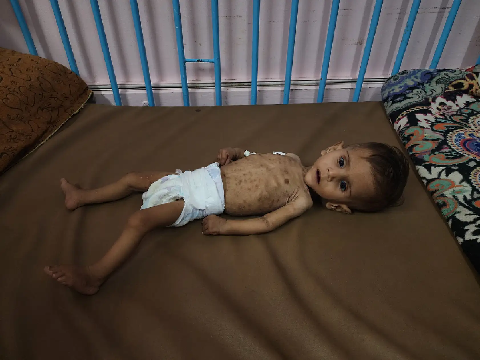 Yetersiz beslenme nedeniyle çocuk ölümleri artıyor!