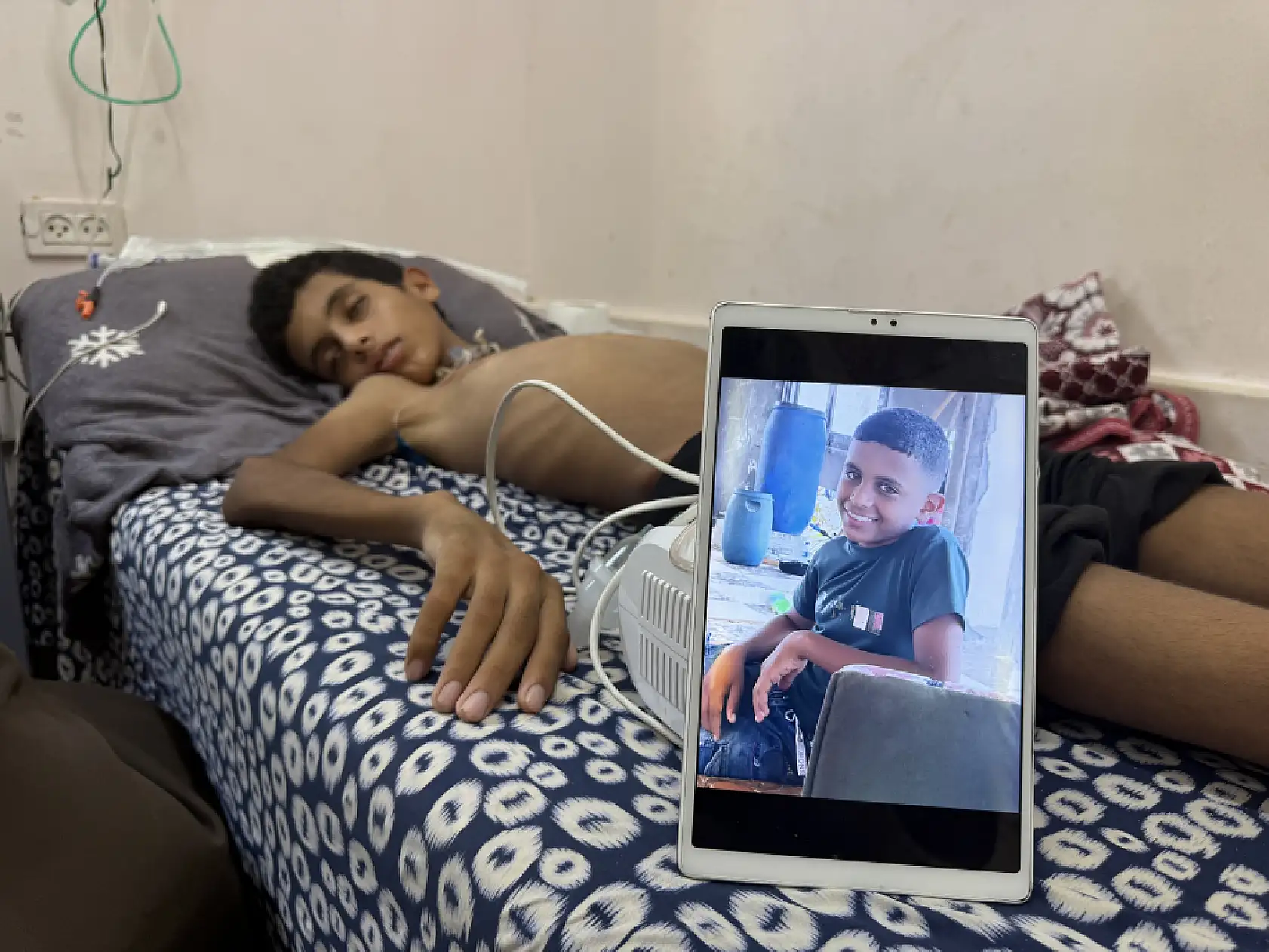 13 yaşındaki çocuk yaşam mücadelesi veriyor