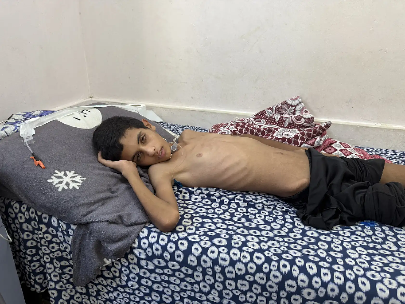 13 yaşındaki çocuk yaşam mücadelesi veriyor