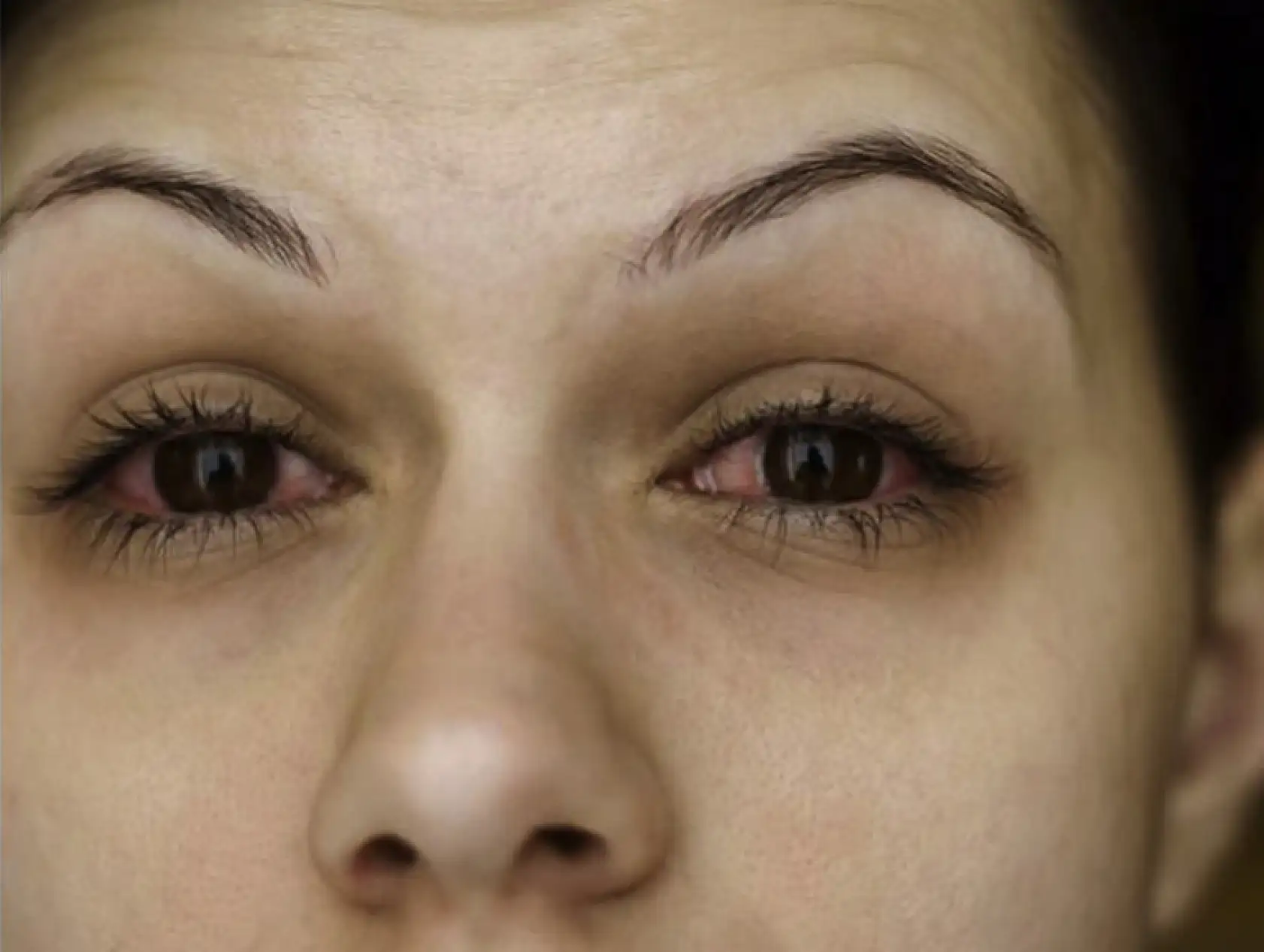 Göz sağlığına dikkat!