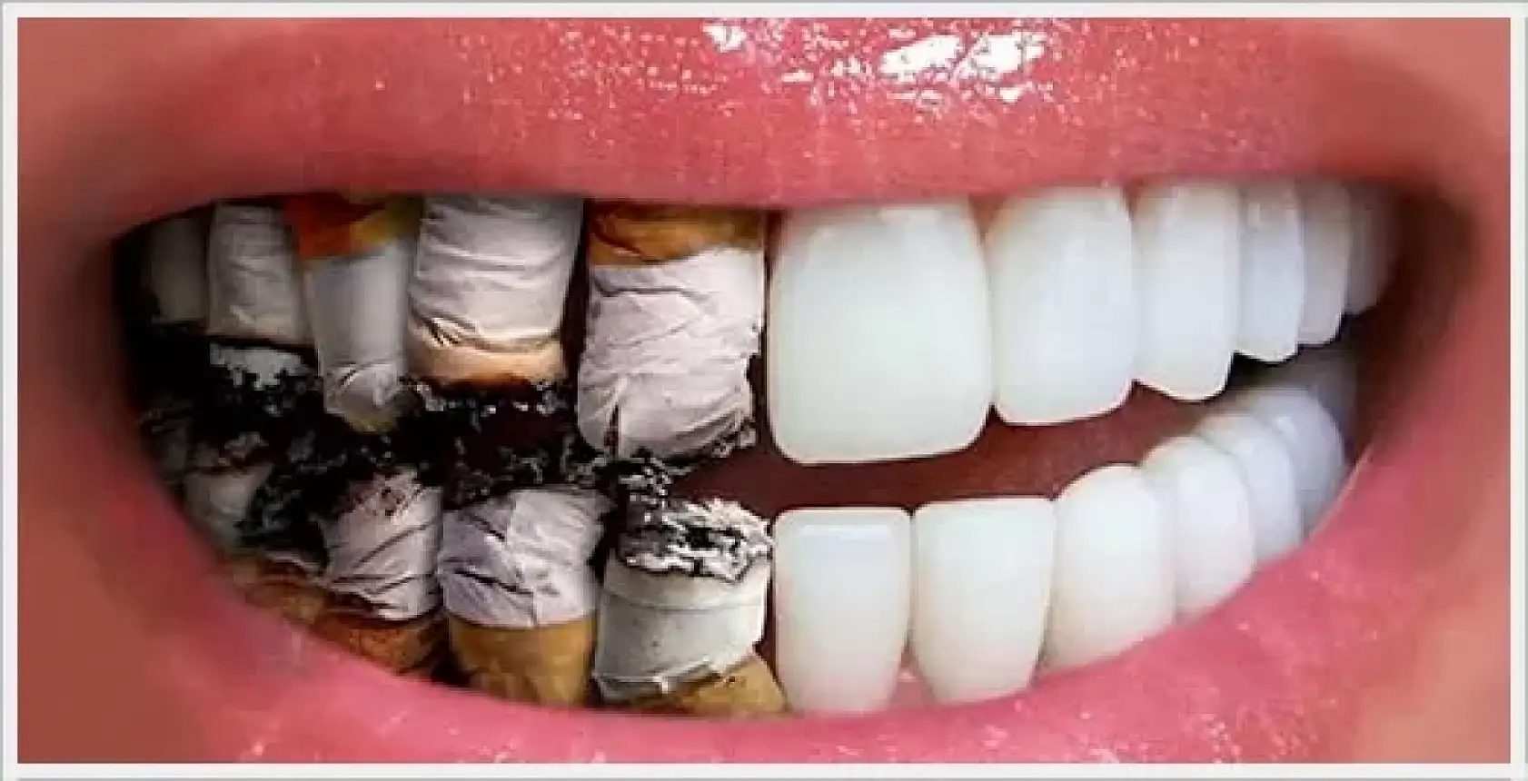 Sigara, ağız ve diş sağlığını tehdit ediyor