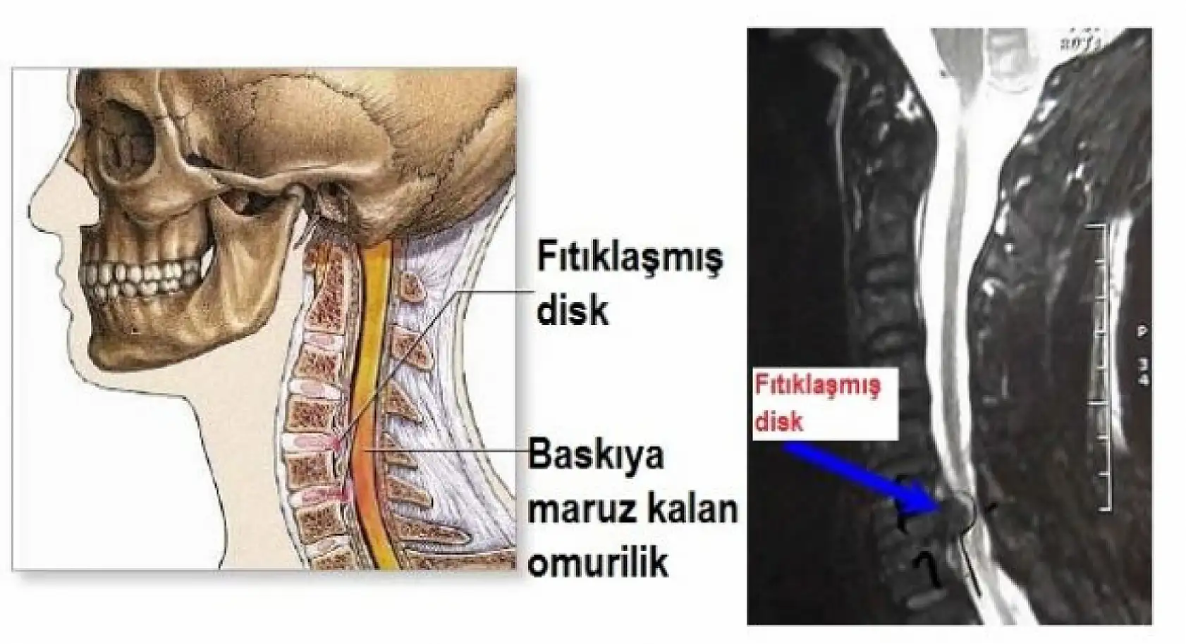 Boyun sağlığınızı korumak için bu 5 kurala dikkat!