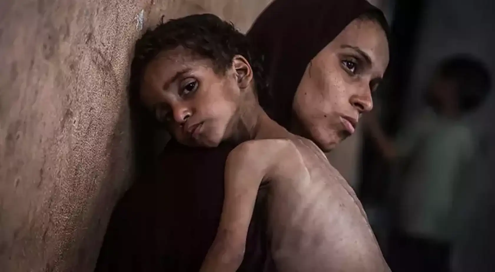 Açlıktan hayatını kaybedenlerin sayısı 263'e yükseldi