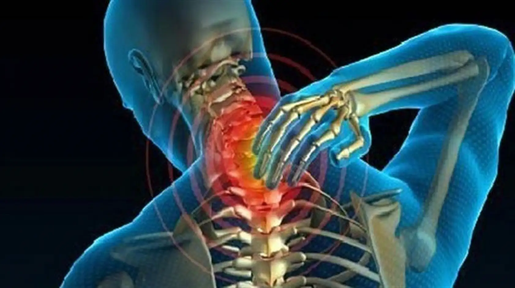 Boyun ağrısı, bel fıtığının uyarısı mı?