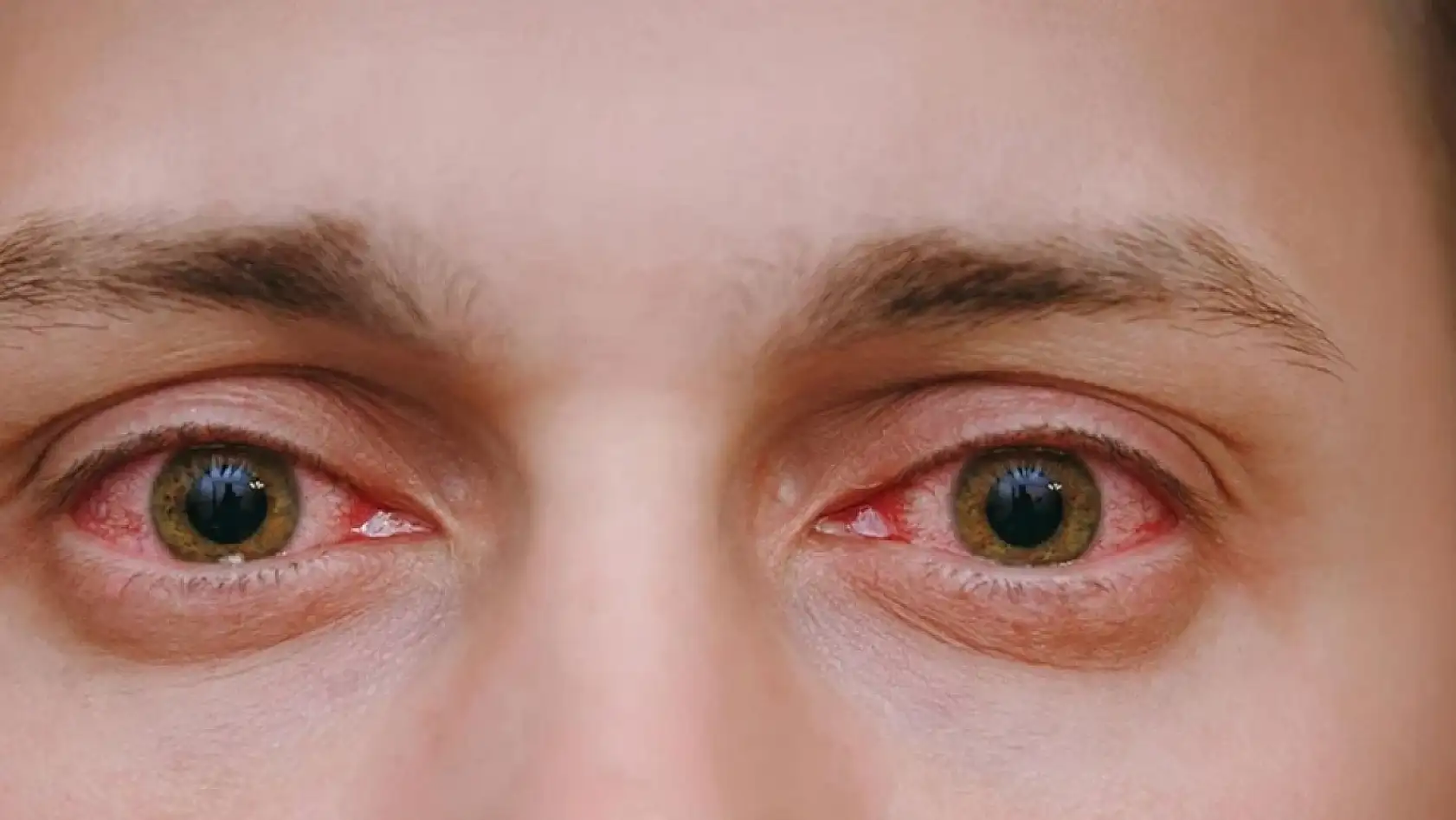 Göz sağlığına dikkat!