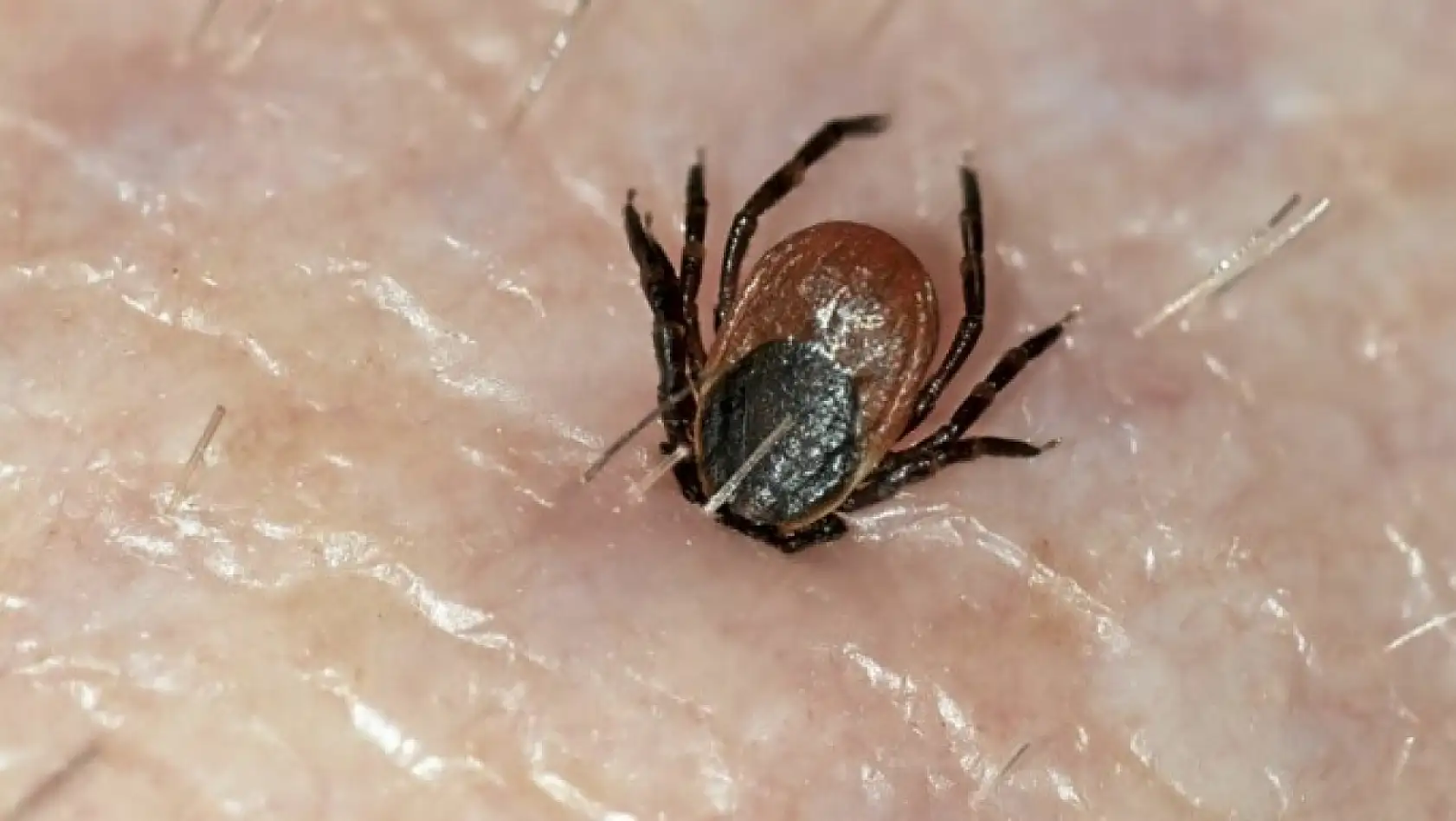 Türkiye'de kene alarmı: Kene vaka sayısı artıyor mu?