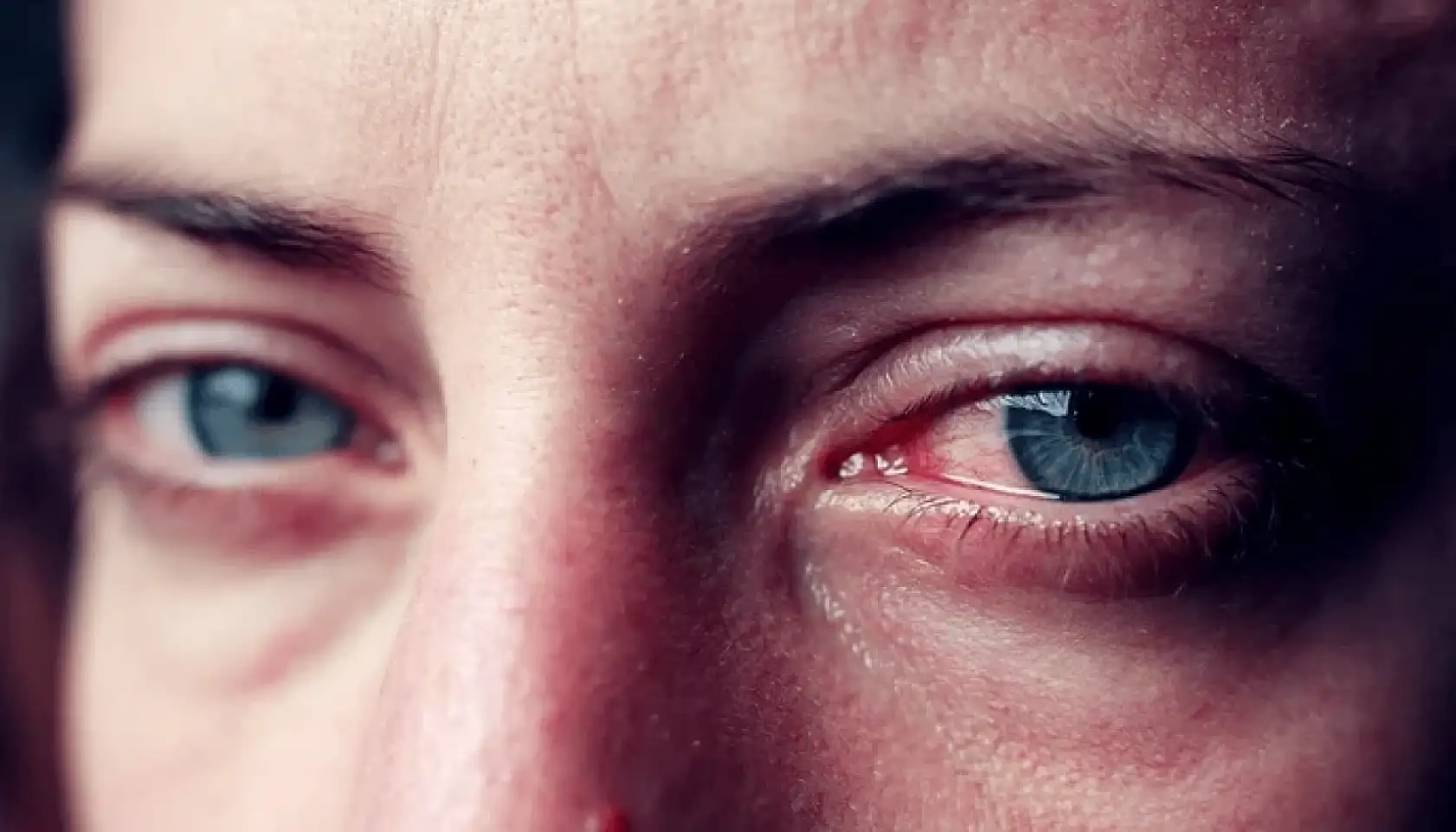 Göz sağlığına dikkat!