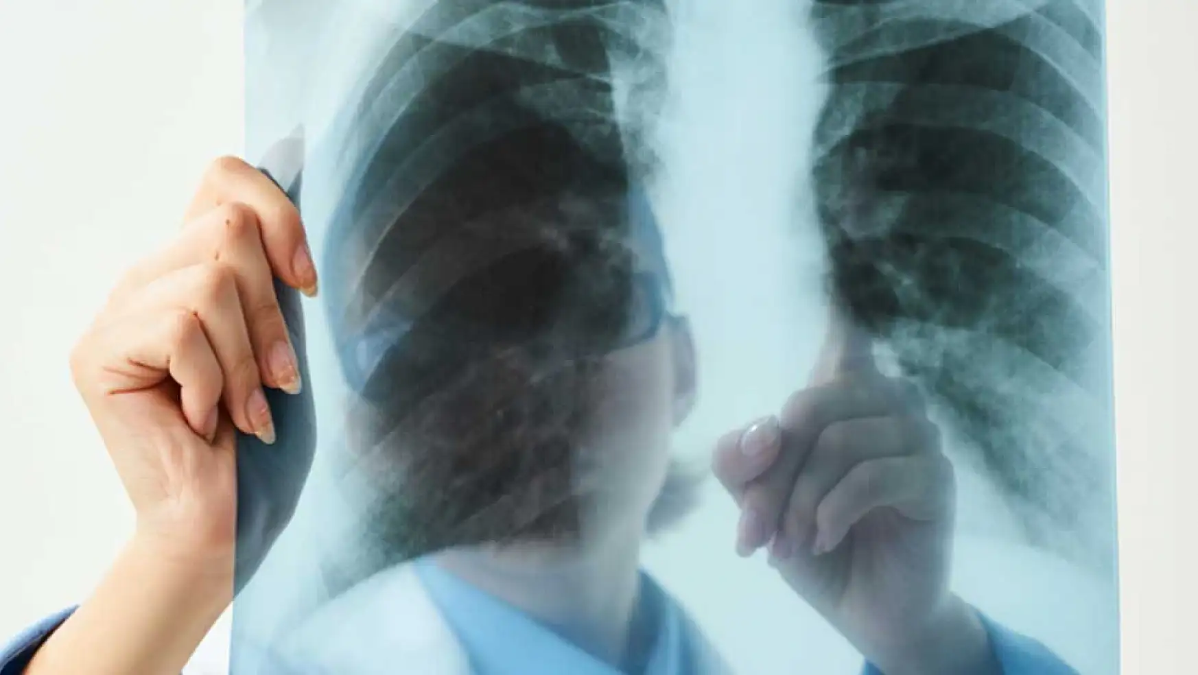 Akciğer Embolisi nedir? Ciddi bir sağlık tehlikesi Akciğer Embolisi nasıl anlaşılır?