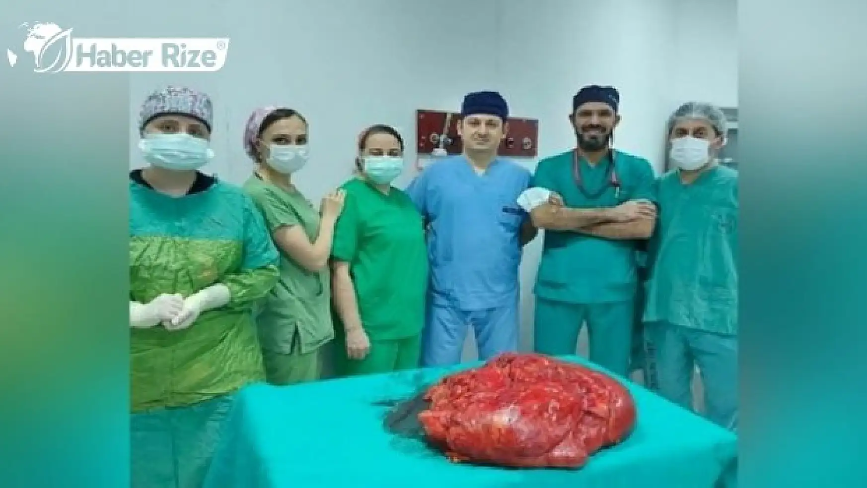 Gürcü kadının kolunda çoklu kitle tespit edidi  Trabzon'da ameliyatla alındı