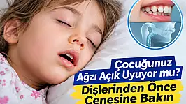 Çocuğunuz ağzı açık mı uyuyor? Dişlerinden önce çenesine bakın