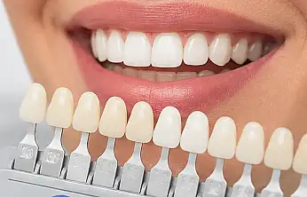 Diş Hekimi Kurşun uyardı: Beyaz diş takıntısı sağlığınızı tehdit edebilir