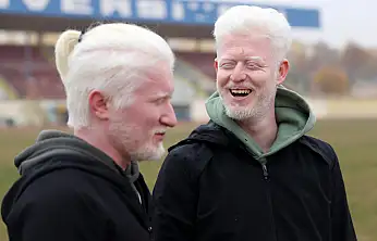 Konya'da 'dostluk' hikâyesi: Atletizm pisti buluşturdu, albinizm kenetledi