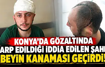 Konya'da gözaltında darp edildiği iddia edilen şahıs beyin kanaması geçirdi!