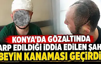 Konya'da gözaltında darp edildiği iddia edilen şahıs beyin kanaması geçirdi!