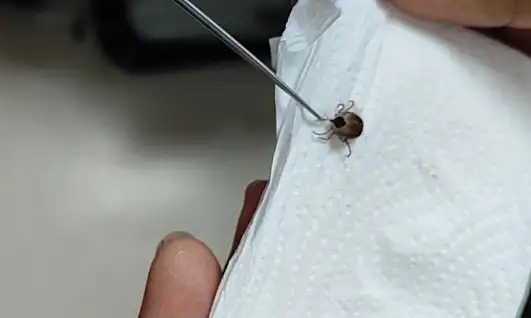 5 yaşındaki çocuğun kulağındaki ağrının nedeni şoke etti! Doktor canlı canlı çıkardı