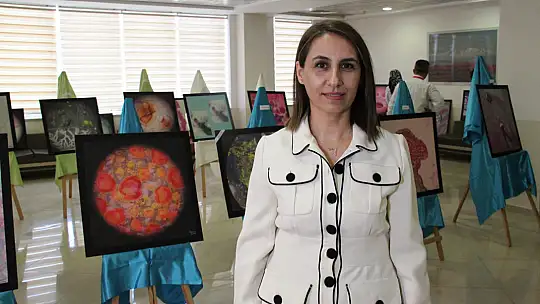 Numune hastanesinde ki hastalıklı dokular sanat eserine dönüştü