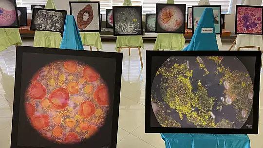 Numune hastanesinde ki hastalıklı dokular sanat eserine dönüştü