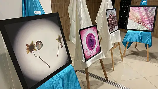 Numune hastanesinde ki hastalıklı dokular sanat eserine dönüştü