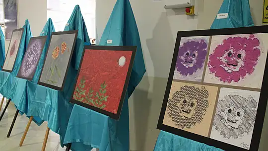 Numune hastanesinde ki hastalıklı dokular sanat eserine dönüştü