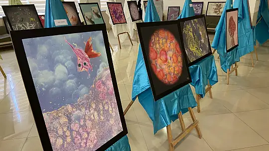 Numune hastanesinde ki hastalıklı dokular sanat eserine dönüştü