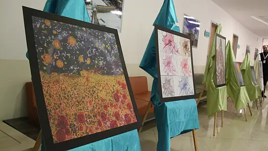 Numune hastanesinde ki hastalıklı dokular sanat eserine dönüştü