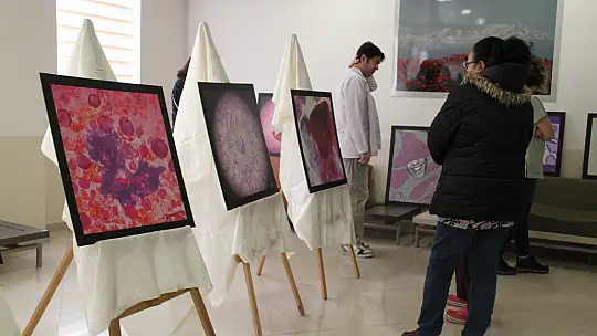 Numune hastanesinde ki hastalıklı dokular sanat eserine dönüştü