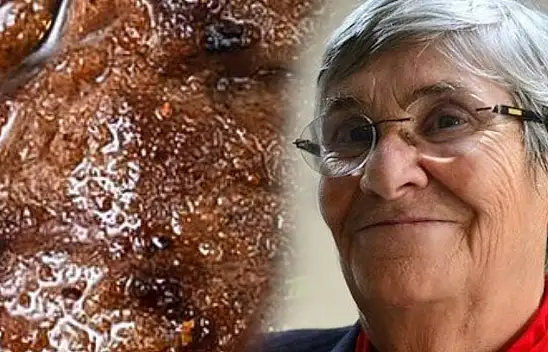 Canan Karatay tavsiye ettiği yemekle şaşırttı! İstediğiniz kadar yiyebilirsiniz…