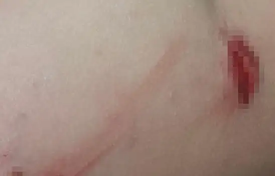 Başkentte başıboş köpek çocuğa saldırdı