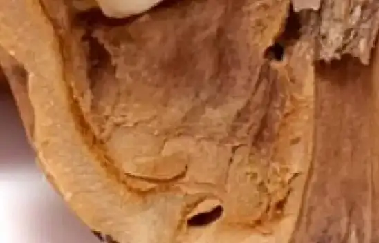 Bugüne kadar hep çöpe atarak ziyan etmişiz… 1 tutamı saç dökülmesi ve kepeği önlüyor.