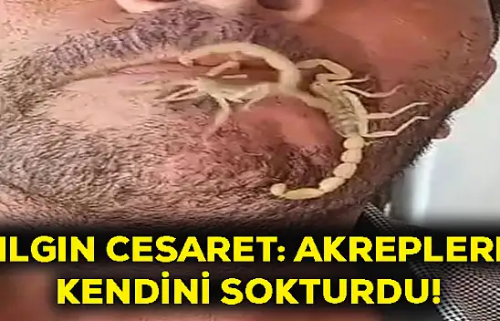 Çılgın cesaret: Akreplere kendini sokturdu!