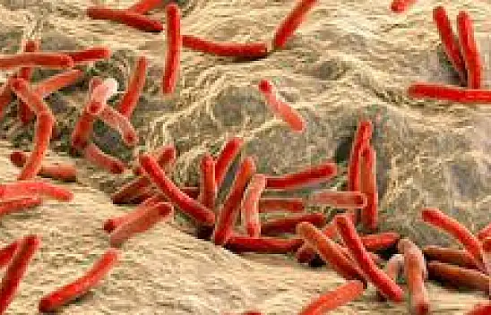 Cüzam Hastalığı: Modern Çağda Tedavi ve Farkındalık