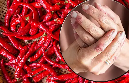 Eldeki biber yanığı nasıl geçer? Yakma hissinden kurtulmak çok basitmiş! İşte çözümü