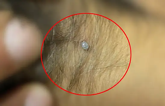 Konya'da kene kabusu! 4 yaşındaki çocuğun...