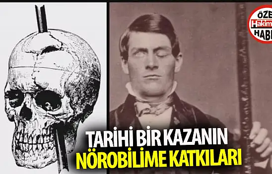 Phineas Gage: Tarihi Bir Kazanın Nörobilime Katkıları