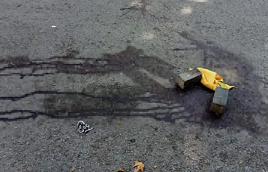 Sevgililerin babaları kavga etti. 1 ağır yaralı