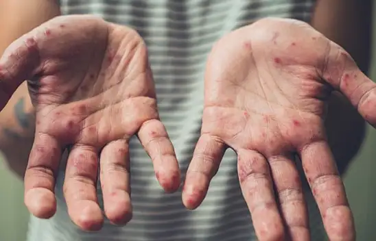 Tatilde ortak kullanım alanlarına dikkat