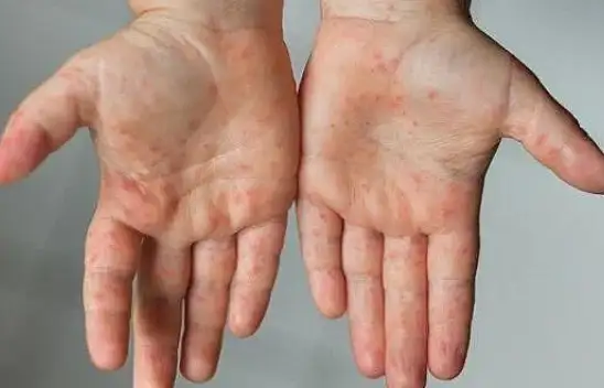 TTB'den uyarı: hepimiz etkileneceğiz