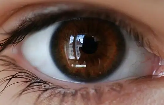 Uzmanı uyardı!Gözde sinek uçuşması ve ışık çakmasına dikkat !