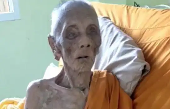 Yaşayan ölü:399 yaşındaki Türk