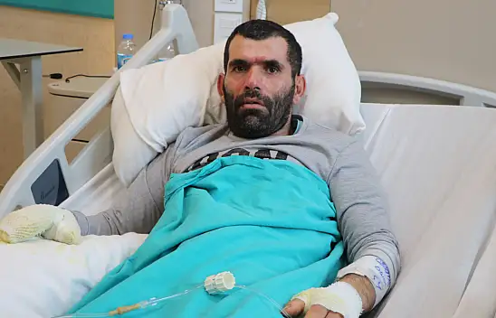 Yemek yaparken sobaya düştü!