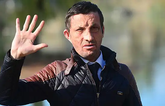 Yüz nakli sayesinde artık aynalarla barışık