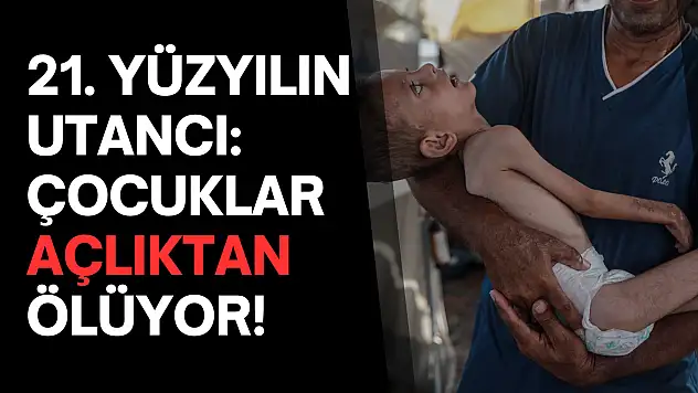 21. Yüzyılın utancı: Uzay çağında açlıktan ölen çocuklar!