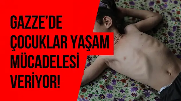 5 yaşındaki Dalya, oksijen eksikliği ve yetersiz beslenme sorunuyla mücadele ediyor