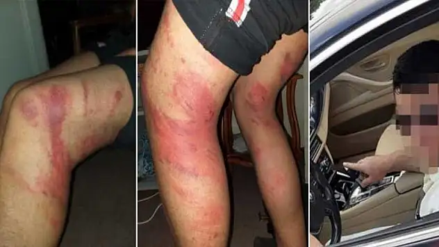 Konya'daki triger kayışlı işkence olayında usta için istenen ceza belli oldu