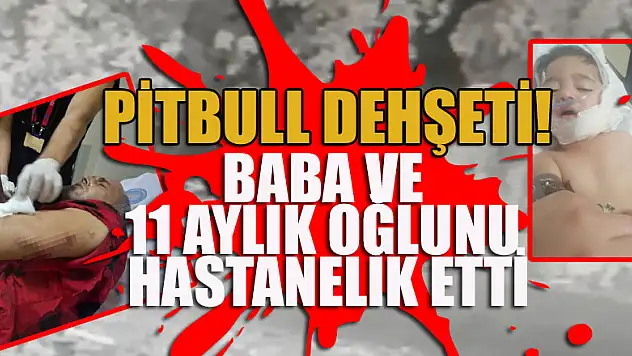 Pitbull dehşeti! Baba ve 11 aylık oğlunu hastanelik etti