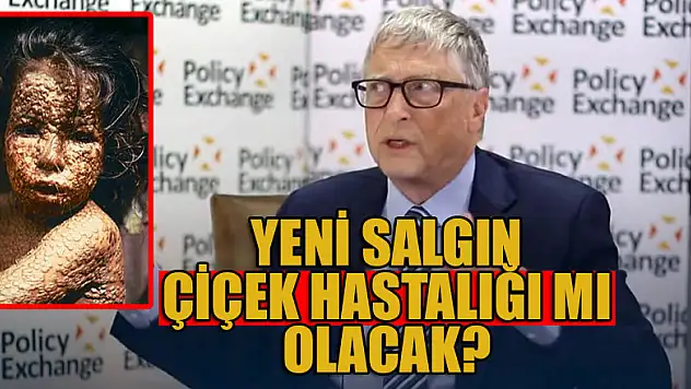 Yeni salgın Çiçek hastalığı mı olacak?