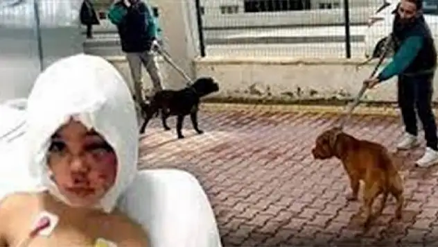 Pitbull saldırısına uğrayan küçük Asiye olayında yeni gelişme!