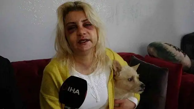 Hatay'da yalnız yaşayan kadın evinde darp edildi